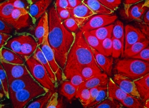 Immunofluorescent LM of normal breast cells Immunofluorescent LM of normal breast cells