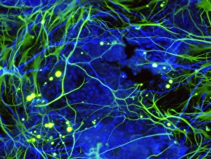 Stem Cell Gallery: Induced nerve stem cells, micrograph