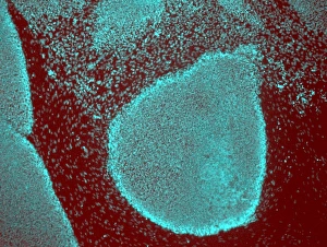 Stem Cell Gallery: Induced stem cells, light micrograph