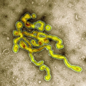 Influenzavirus C, TEM Influenzavirus C, TEM