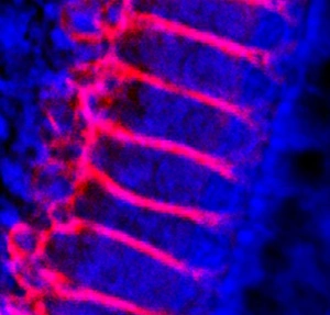Inner ear hair cells, light micrograph Inner ear hair cells, light micrograph
