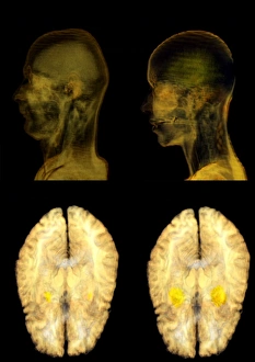 Jealousy research, MRI brain scans C016/9633 Jealousy research, MRI brain scans C016/9633