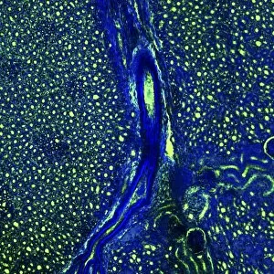 Confocal Gallery: Kidney blood vessels, confocal micrograph C014 / 4608