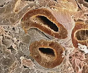 Images Dated 10th March 2005: Kidney tubules, SEM