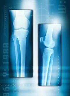 Images Dated 14th September 2005: Knee joint from front and side, X-ray
