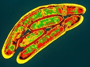 Images Dated 15th December 1998: Legionella bacteria