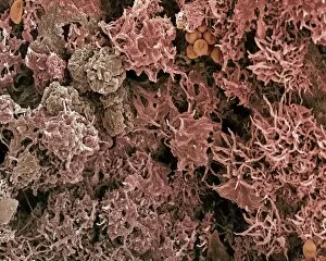 Images Dated 9th August 2002: Lichen, SEM