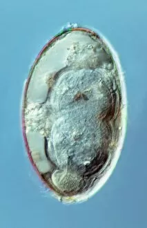 Worms Gallery: Liver fluke egg, macro photograph