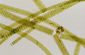 LM of the colonial diatom Fragillaria sp LM of the colonial diatom Fragillaria sp