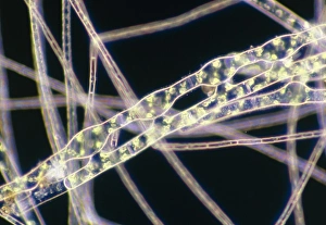 LM of conjugating filaments of Spirogyra LM of conjugating filaments of Spirogyra