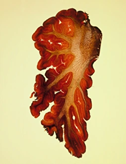 LM of a cross section of cerebellar tissue LM of a cross section of cerebellar tissue