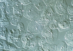 LM of epithelial cells from the human mouth LM of epithelial cells from the human mouth