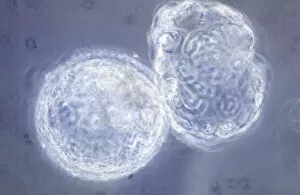 Images Dated 22nd August 1990: LM of hatching blastocyst in IVF