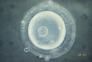 LM of immature human oocyte with germinal vesicle LM of immature human oocyte with germinal vesicle