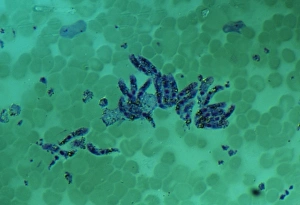 LM of malaria parasite Plasmodium berghei in mouse LM of malaria parasite Plasmodium berghei in mouse