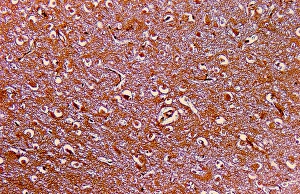Cell Body Gallery: LM of nerve cells and fibres in brain tissue