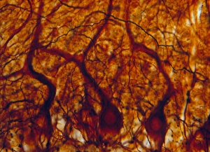 LM of purkinje nerve cells in the cerebellum LM of purkinje nerve cells in the cerebellum