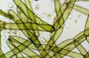 LM of Vorticella ciliates on a green alga