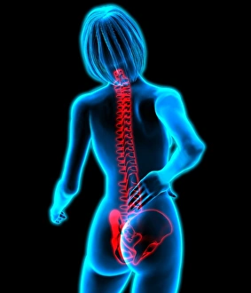 Lower Back Pain Print