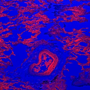 Confocal Gallery: Lung tissue, confocal micrograph C014 / 4616