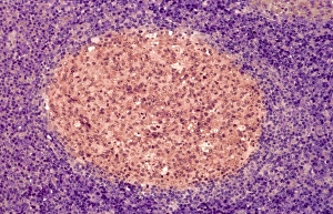Differentiation Gallery: Lymph node, light micrograph
