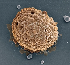 Mast cell, SEM Mast cell, SEM