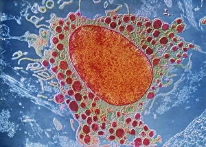 Mast cell, TEM Mast cell, TEM
