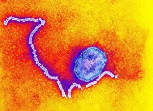 Measles virus particle, TEM C015/7164