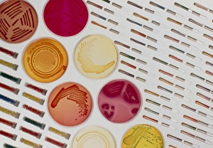 Media use for growing or storing bacteria Media use for growing or storing bacteria