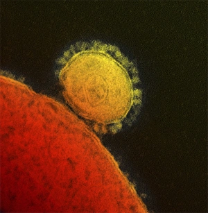 MERS coronavirus, TEM C017/8300 MERS coronavirus, TEM C017/8300