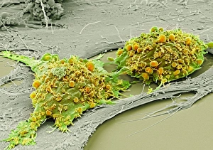 Differentiation Gallery: Mesenchymal stem cells, SEM