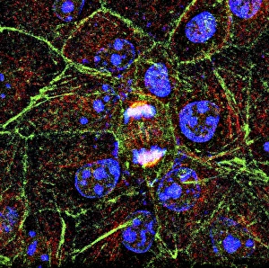 Fluorescence Micrograph Gallery: Mitosis, fluorescence micrograph