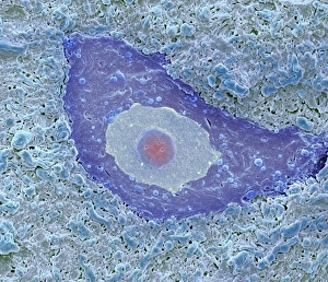 Cell Body Gallery: Motor neuron, SEM
