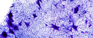 Cell Body Gallery: Motor neurones, light micrograph