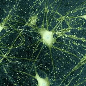 Central Nervous System Gallery: Motor neurons, light micrograph