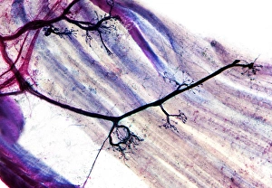 Cell Body Gallery: Muscle motor neurones, light micrograph