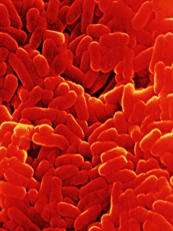 Mycobacterium tuber- culosis bacteria Mycobacterium tuber- culosis bacteria