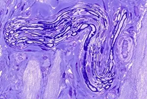 Myelinated nerve, light micrograph