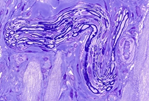 Nuclei Gallery: Myelinated nerve, light micrograph