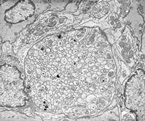 Cell Body Gallery: Myenteric nerve plexus, TEM