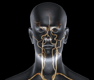 Neck and head arteries, MRA scan C016/6449 Neck and head arteries, MRA scan C016/6449