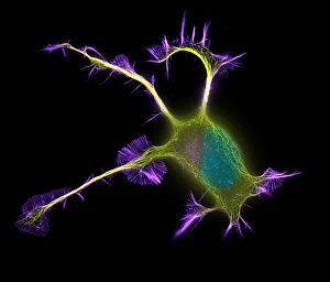 Differentiation Gallery: Nerve cell growth