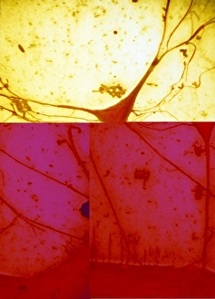 Cell Body Gallery: Nerve cell, SEM C013 / 9772