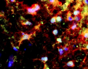 Confocal Gallery: Nerve cell trauma response