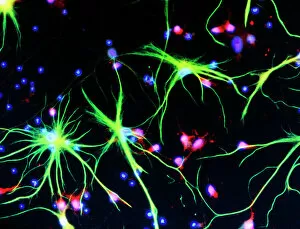 Images Dated 29th September 1992: Nerve cells