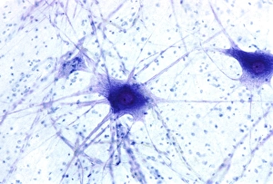 Cell Body Gallery: Nerve cells, light micrograph