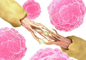 Stem Cell Gallery: Nerve damage and stem cells, artwork