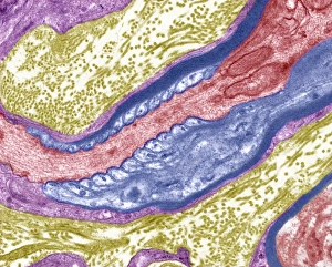 Node Of Ranvier Gallery: Nerve fibre node, TEM C014 / 1458