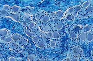 Cell Body Gallery: Nerve ganglion, light micrograph