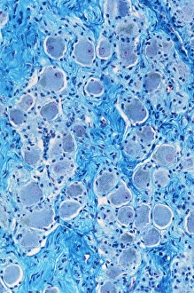 Nuclei Gallery: Nerve ganglion, light micrograph C016 / 0532